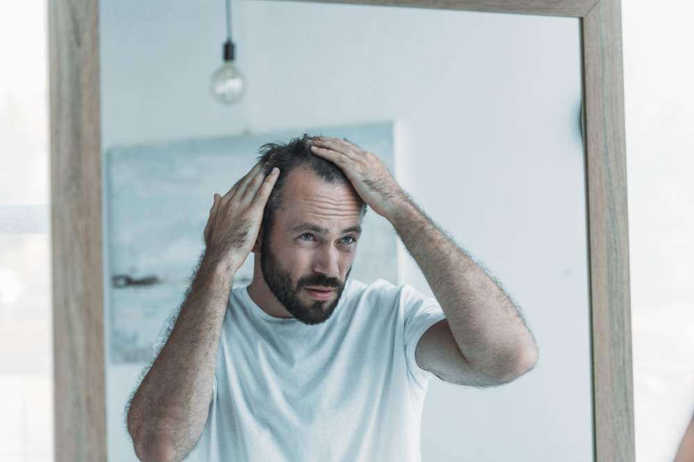 Does Wellbutrin Cause Hair Loss?